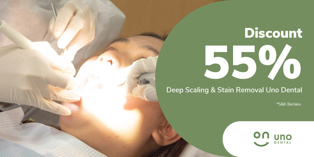 Gambar promo Discount 55% Deep Scaling & Stain Removal Uno Dental dari Uno Dental